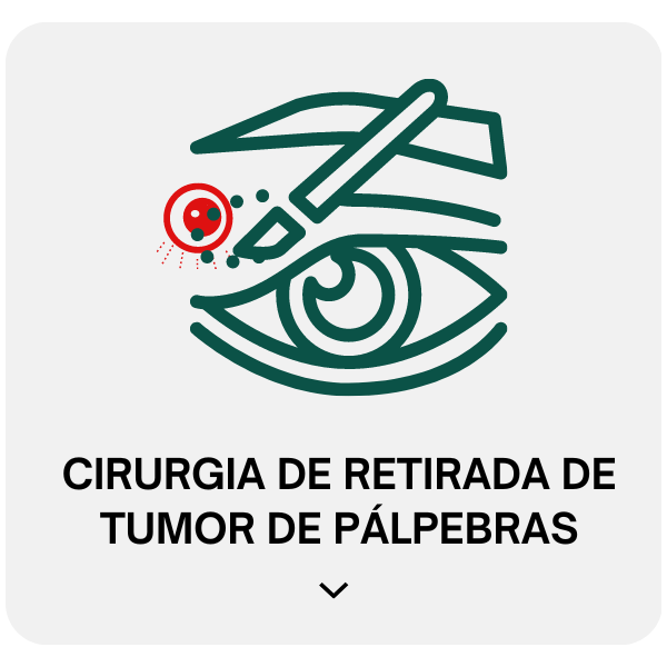 Cirurgião de Pálpebras - Dr. Márcio Isabella | Especialista Ocular