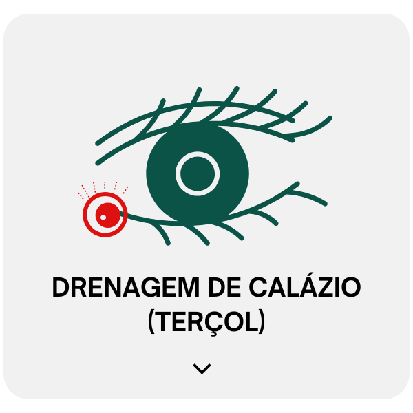 Cirurgia de Drenagem de Calazio Terçol Salvador (1)